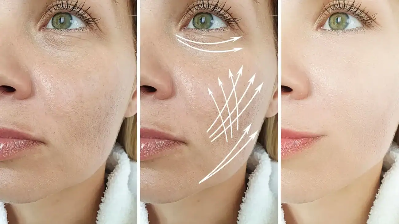 Can One Treatment Really Tackle More Than One Skin Concern Surrey?