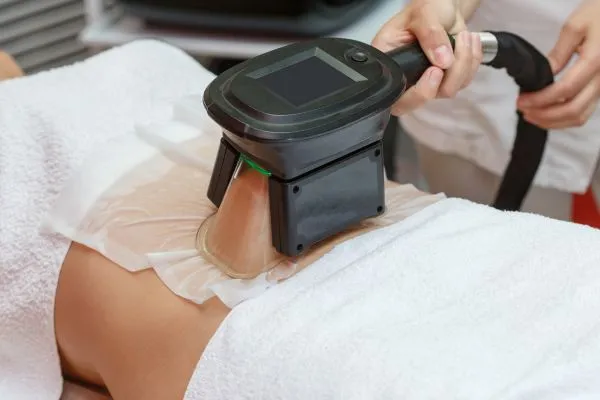 Image of person having fat freezing treatment to help weight gain Surrey