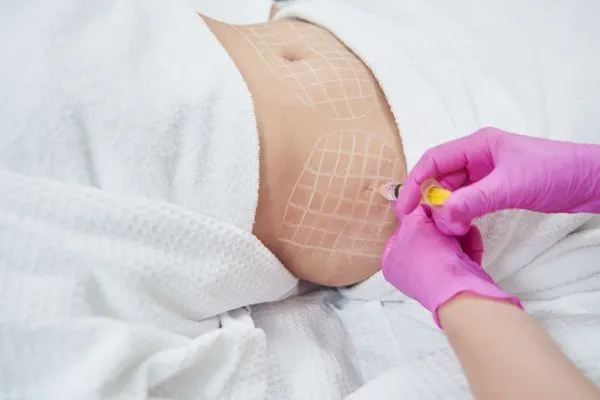 image of fat dissolving injections on love handles to help combat weight gain Surrey