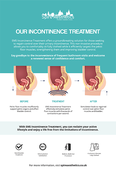 image to show how EMS treatment works for female urinary incontinence Surrey