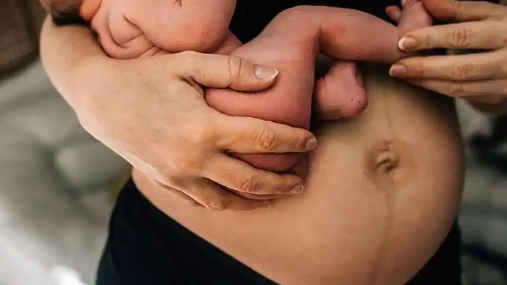 Why Is My Stomach Still Big After Pregnancy Surrey?